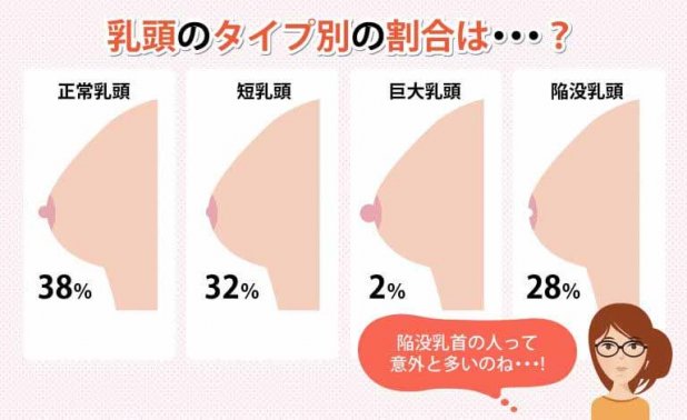 乳首のタイプ別の割合